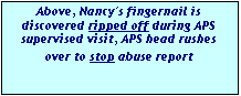 Text Box: Above, Nancy's fingernail is discov-ered ripped off during APS supervised visit, APS head rushes over to stop abuse report