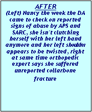 Text Box: AFTER
(Left) Nancy the week the DA came to check on reported signs of abuse by APS and SARC, she isn't clutching herself with her left hand anymore and her left shoulder appears to be twisted, right at same time orthopedic expert says she suffered unreported collarbone frac-ture
