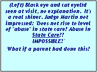 Text Box: (Left) Black eye and cut eyelid seen at visit, no explanation.  It's a real shiner. Judge Martin not impressed: 'Does not rise to level of "abuse" in state care? Abuse in State Care??
 IMPOSSIBLE!'
 What if a parent had done this? 
